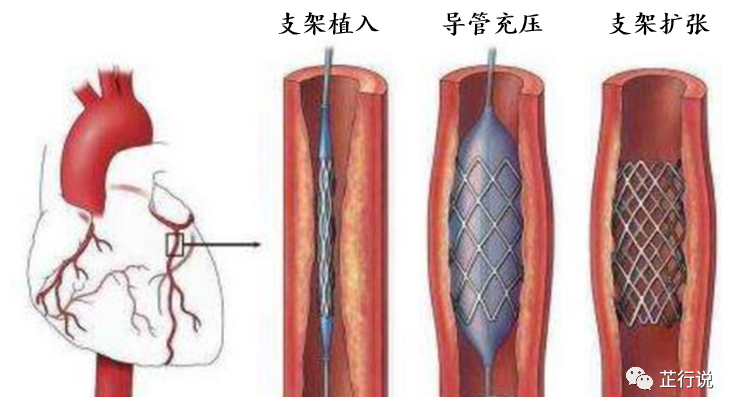 ansys中怎样旋转模型